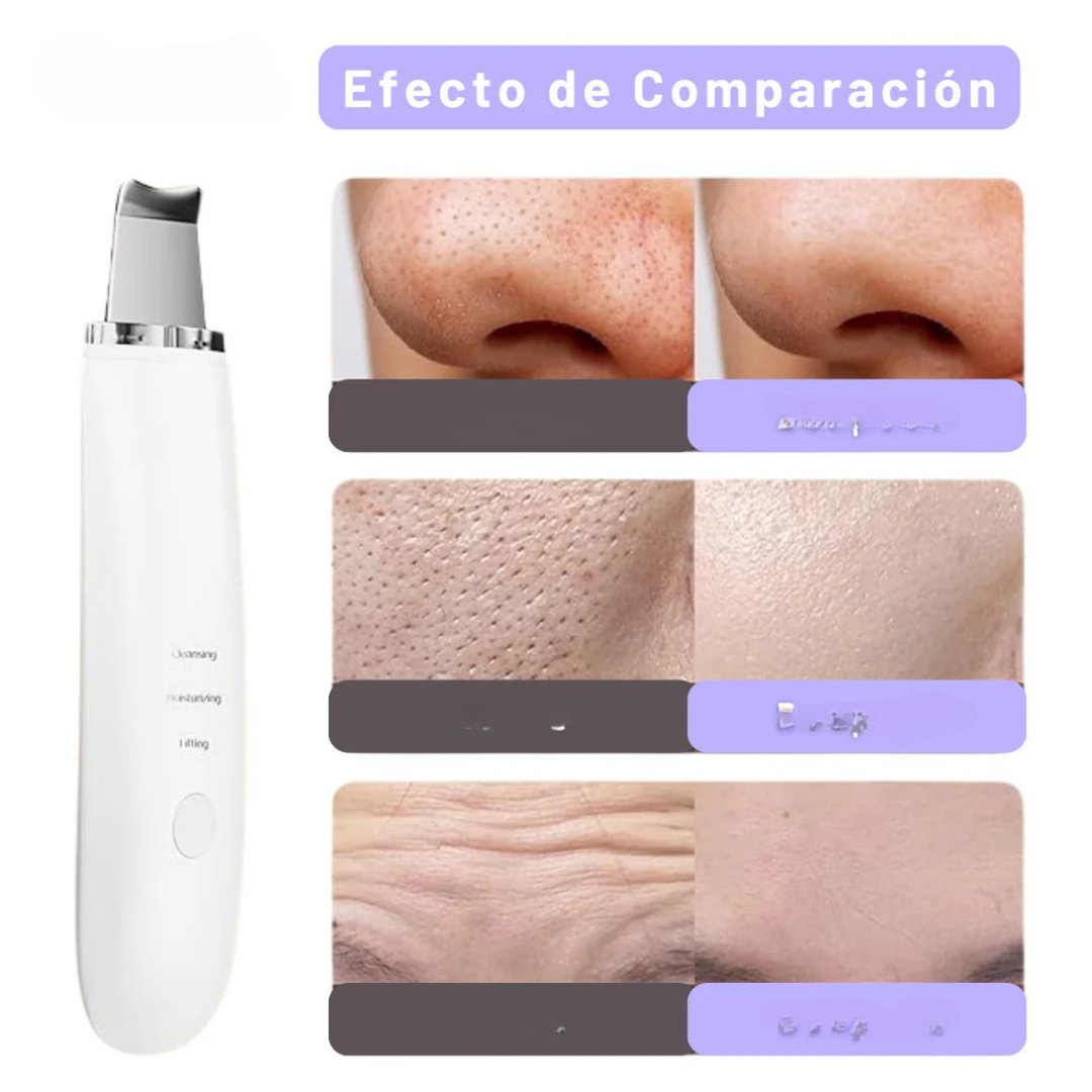 UltraGlow™ / Limpiador facial ultrasónico